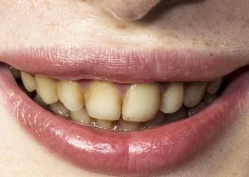 10 ნიშანი იმისა, რომ ქალი თავს არ უვლის და მას ვერცერთი ძვირადღირებული ტანსაცმელი ვერ დაამშვენებს